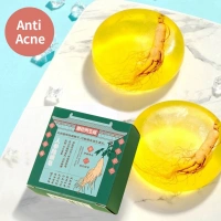 Oem Private Label Nutritional Moisturizing 100% Nature Moisture Soap Anti-itch Soap Anti-mite Soap